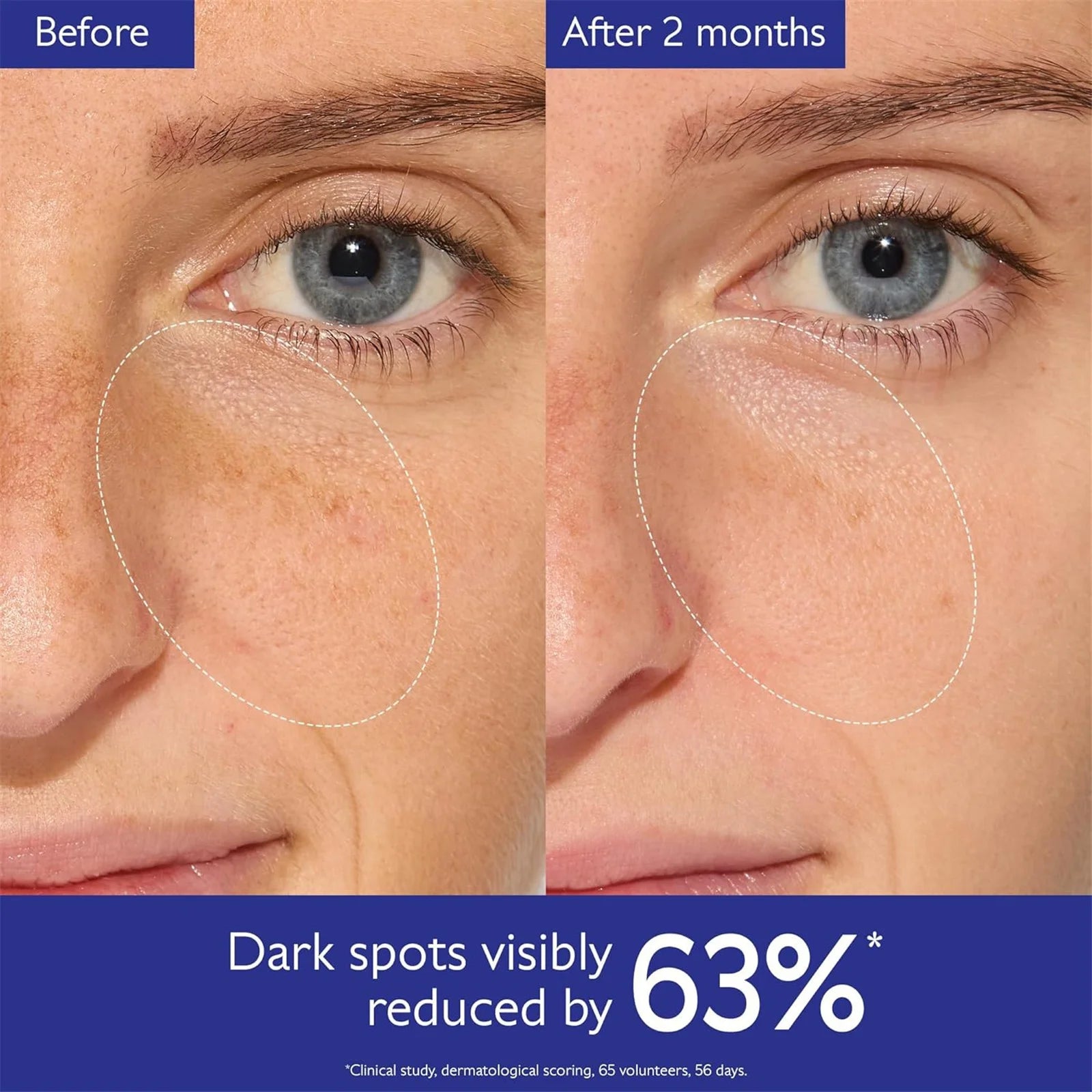 Dark Spot Brightening Serum Vitamin C Alternative - 50ml